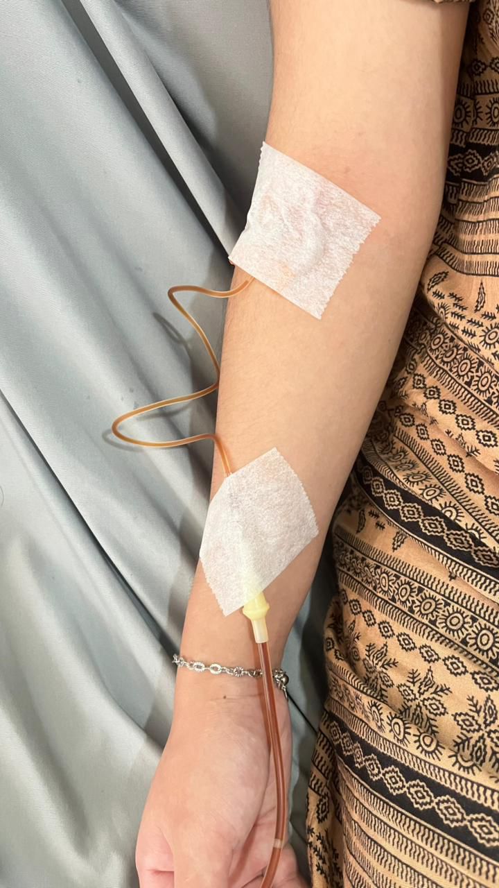 Galeri infus vitamin 10