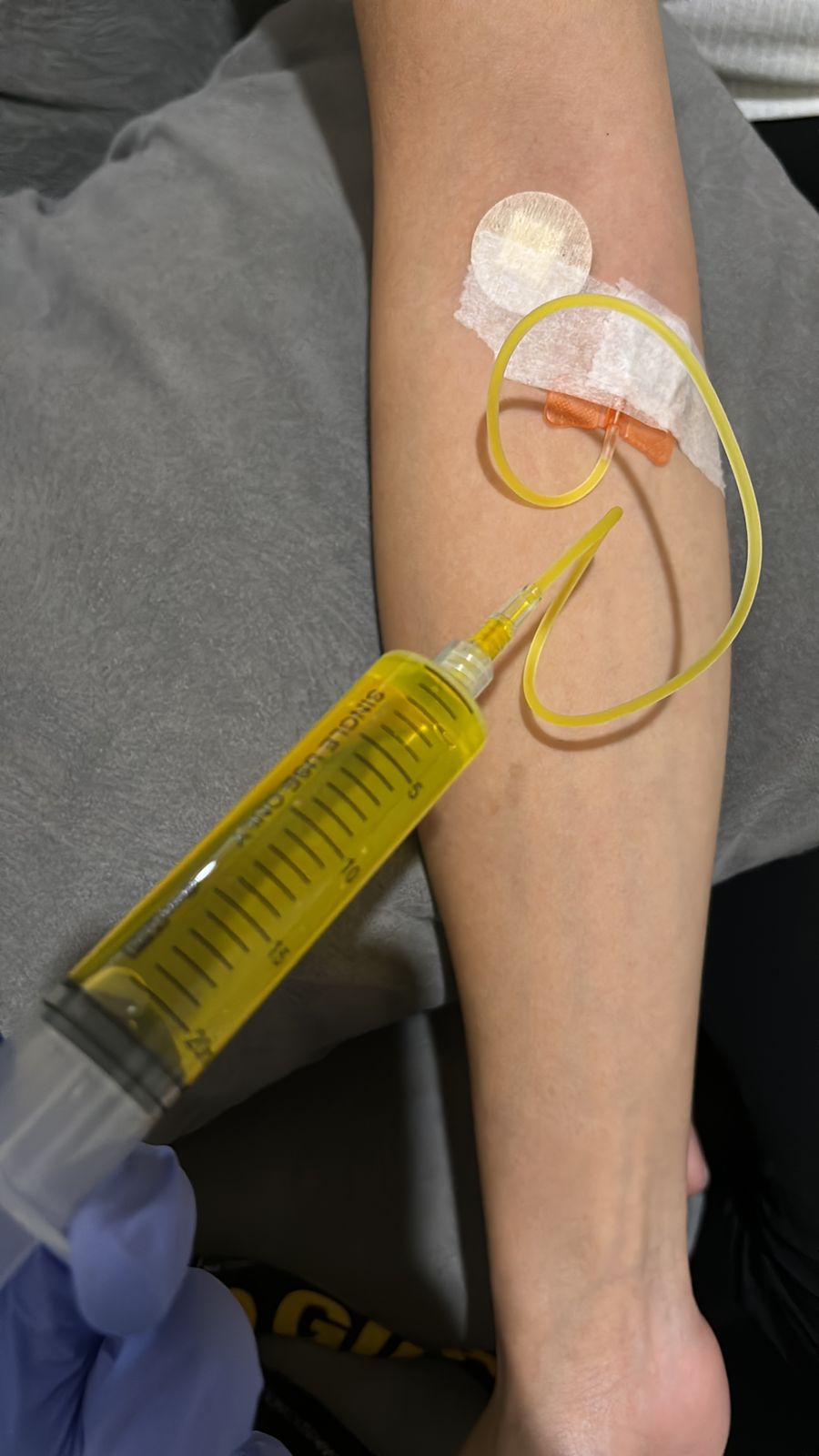 Galeri infus vitamin 7